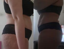 Évolution physique avant après — Coach NutriSport