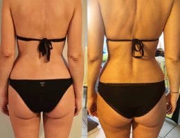 Évolution physique avant après — Coach NutriSport