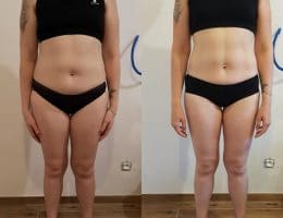 Évolution physique avant après — Coach NutriSport