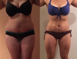 Évolution physique avant après — Coach NutriSport