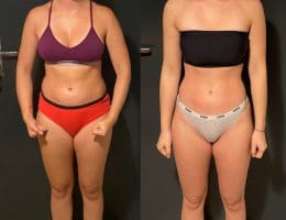 Évolution physique avant après — Coach NutriSport