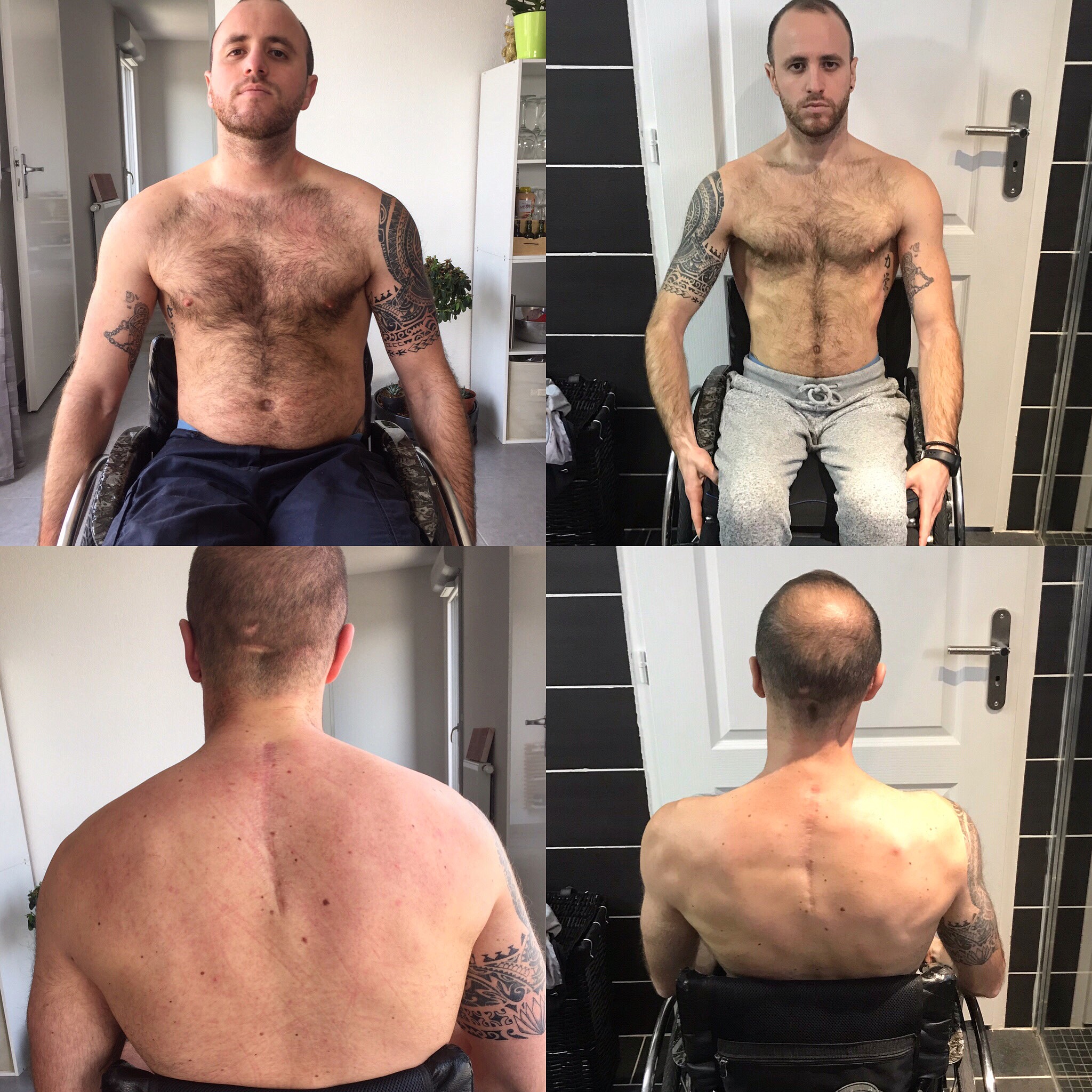 Transformation avant après 3