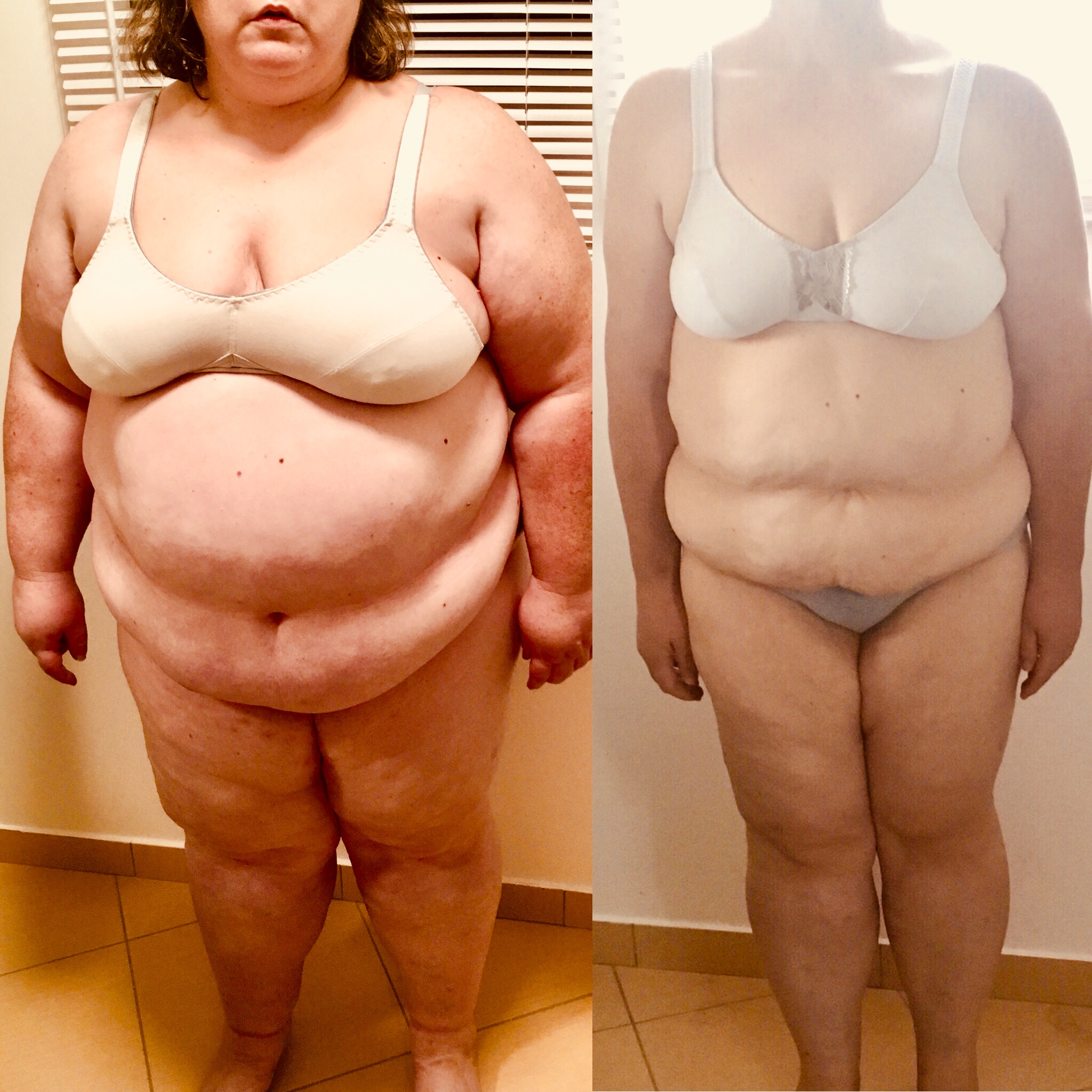 Transformation avant après 7