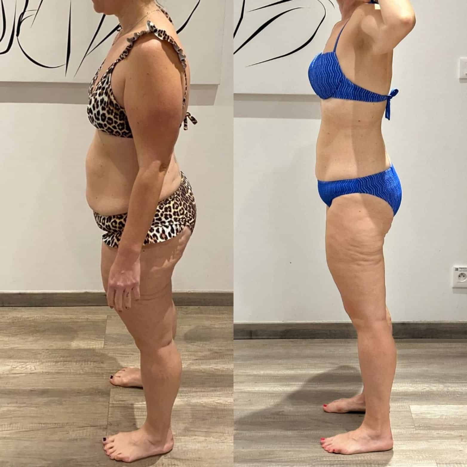 Évolution physique avant après — Coach NutriSport
