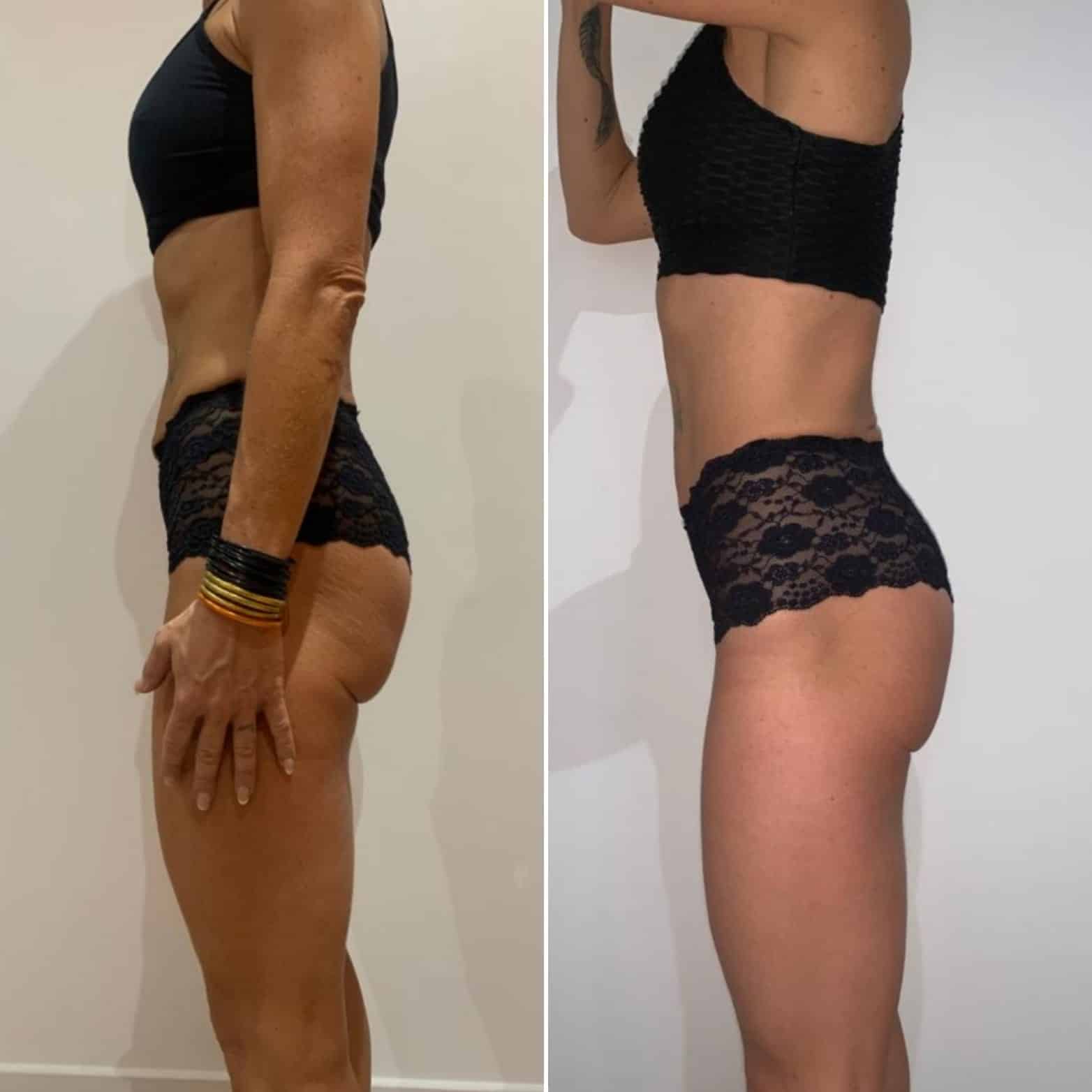Transformation physique avant après — Coach NutriSport