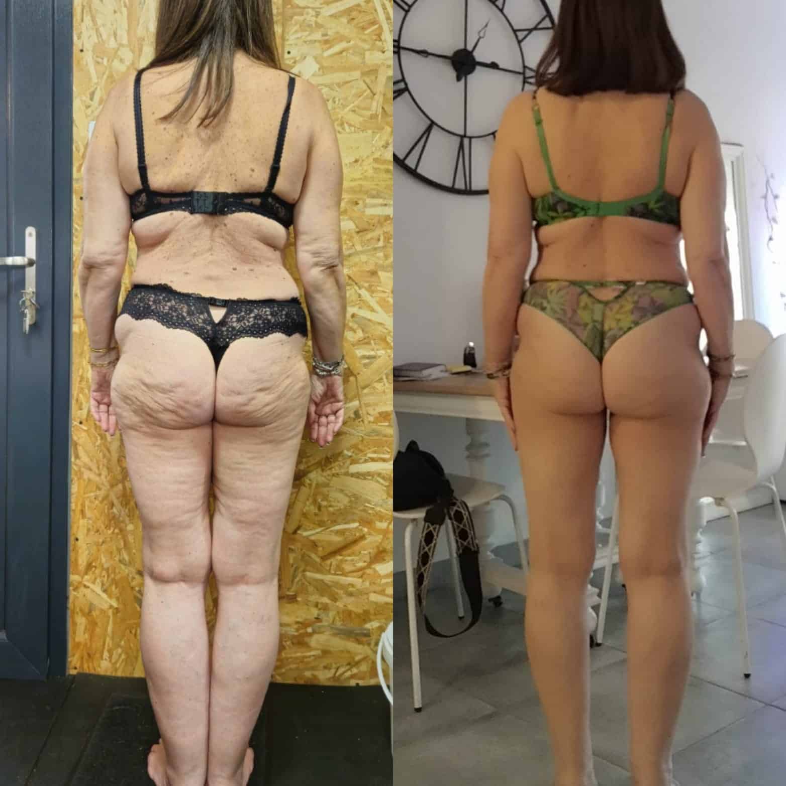 Perte de poids avant après — Coach NutriSport