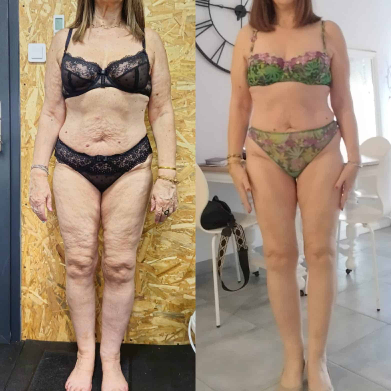 Évolution physique avant après — Coach NutriSport