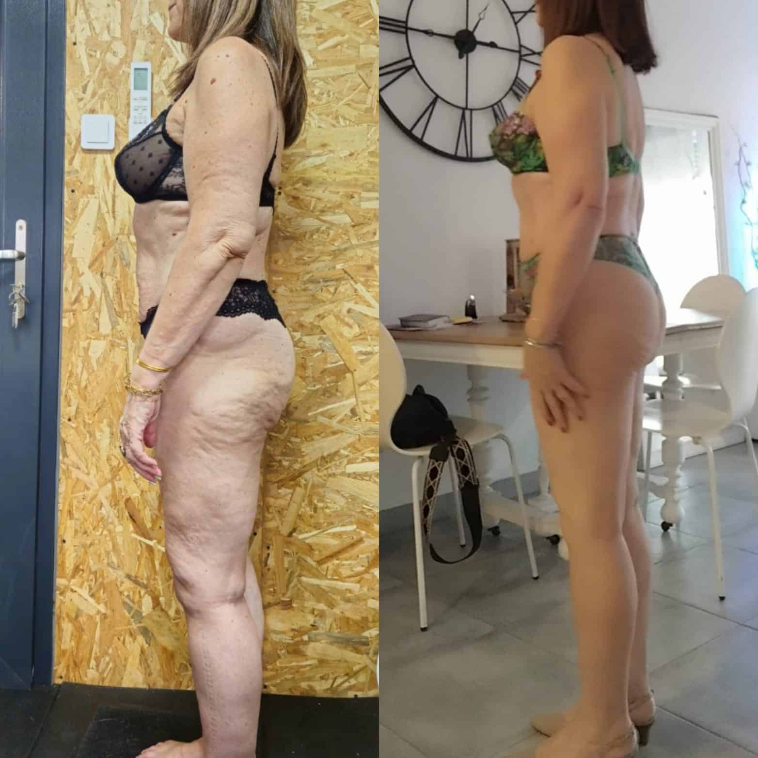 Évolution physique avant après — Coach NutriSport